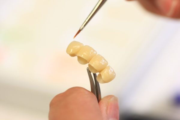 Das Dentallabor Horn verbindet echte Handarbeit mit modernster Technik.